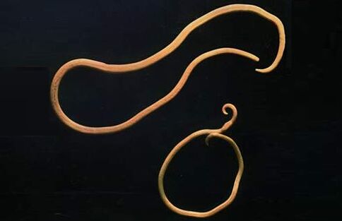 parasitic worms of the human body