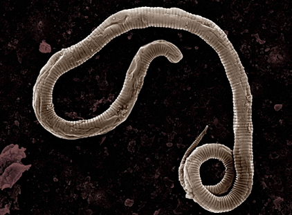 Where do worms come from the human body