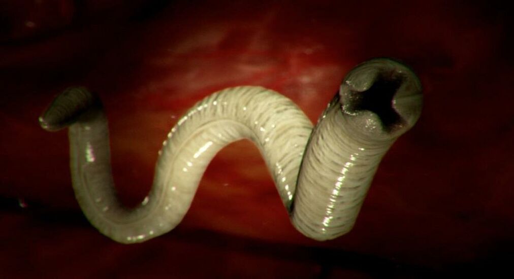 human body worm