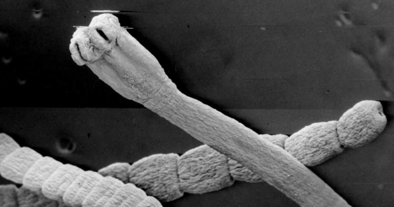 human body worms